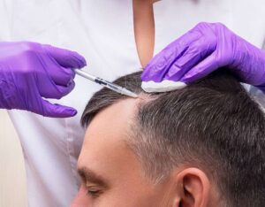 کاشت مو یا PRP؛ کدام روش برای درمان ریزش مو بهتر است؟